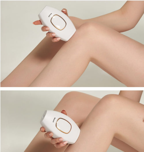 Electric Hair Removal (laser)